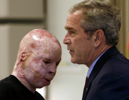 Bush matou dezenas de milhares de pessoas e foi responsável por sofrimentos como o do veterano que aparece nesta foto com ele de 2007