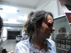 reporterfolhaferidaprotestogiulianavalloneguilhermekastnerbrazilphotopress