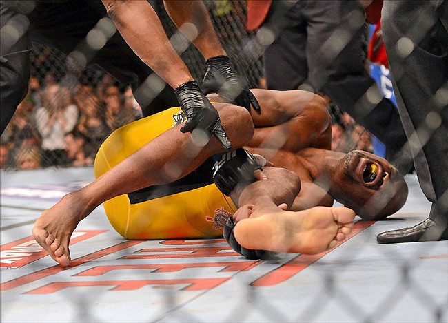 anderson silva perna