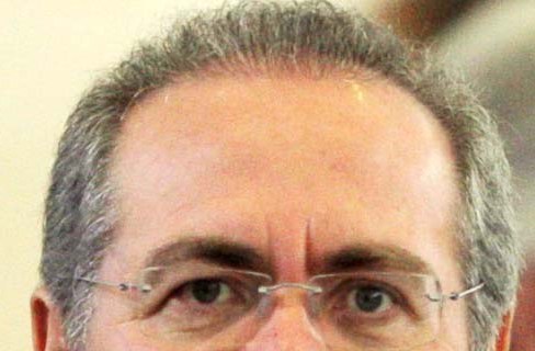 Com tanta coisa para implantar e ele escolheu - cabelo?