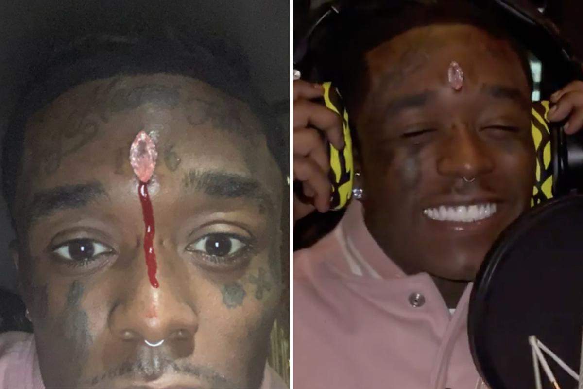 Rapper gasta US$ 24 milhões para implantar diamante na testa e pode