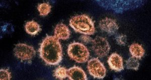 Imagens de microscópio mostram partículas do coronavírus que causam a Covid-19 retiradas de um paciente nos EUA