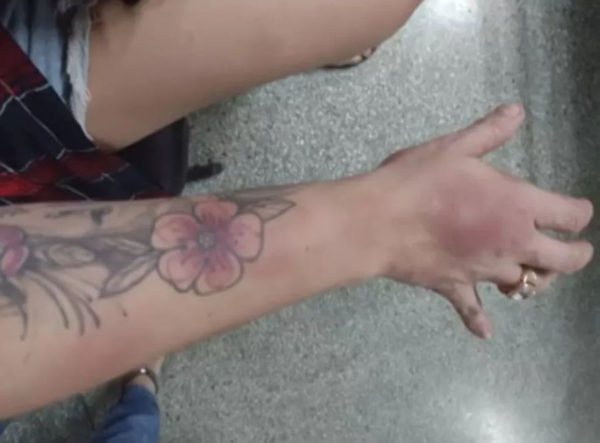 Veja a agressão