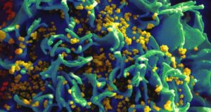 Imagem de tecido com HIV