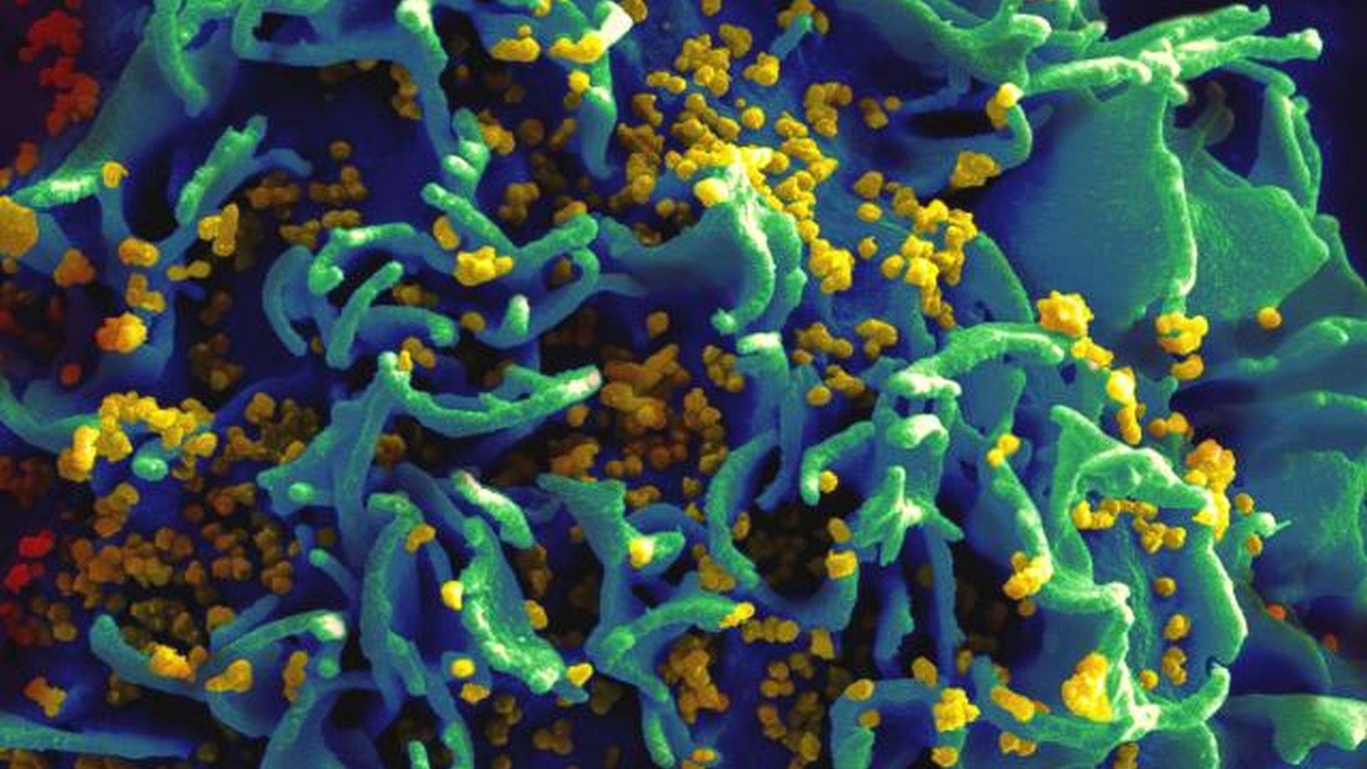 Imagem de tecido com HIV