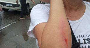 foto do braço da jornalista com escoriações e corte no braço.