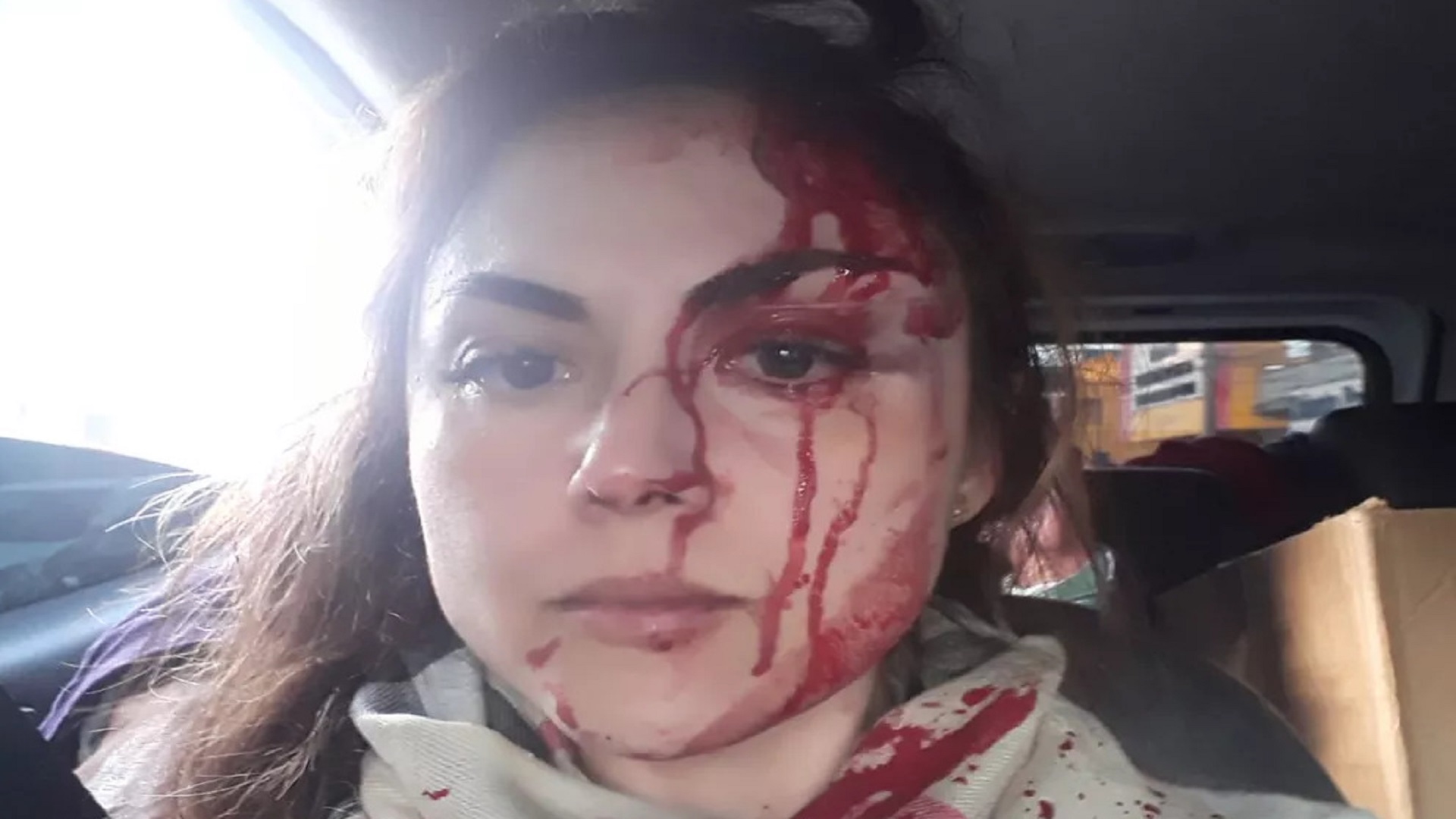 Procuradora agredida