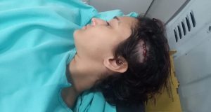 Mulher agredida por bolsonarista deitada em maca com cabeça cortada