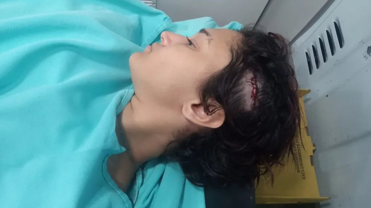 Mulher agredida por bolsonarista deitada em maca com cabeça cortada