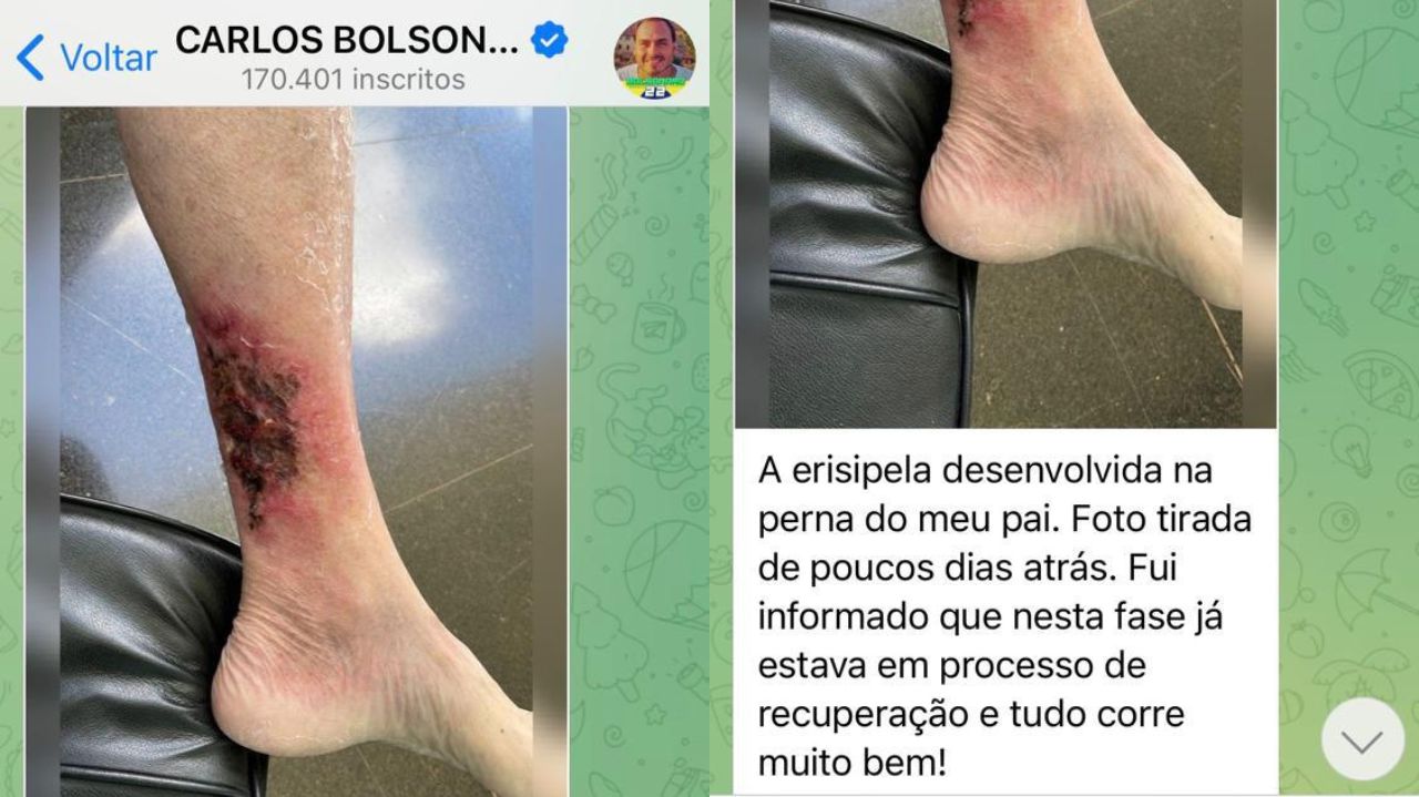 Montagem de fotos de post de Carlos Bolsonaro no Telegram