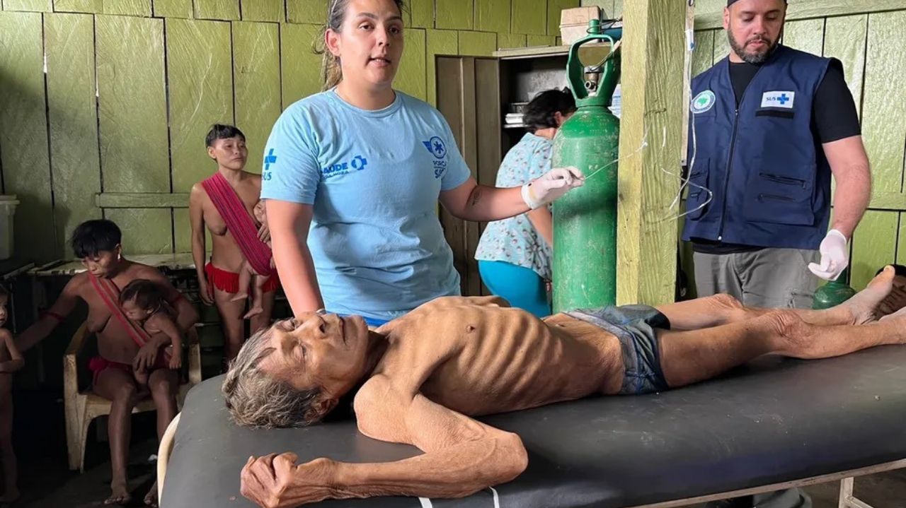 Profissionais da saúde cuidando de indígena desnutrido