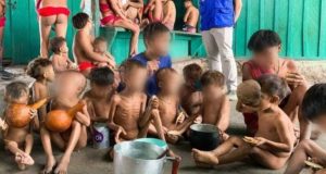 crianças yanomami desnutridas