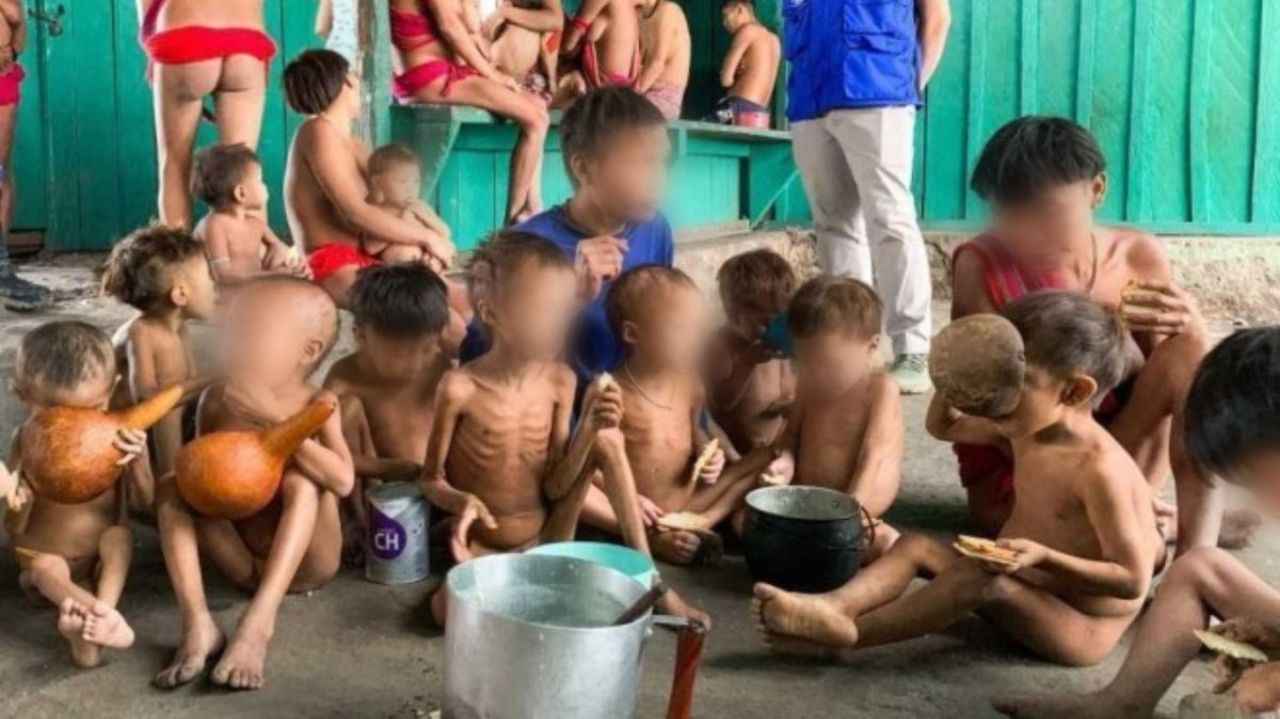 crianças yanomami desnutridas