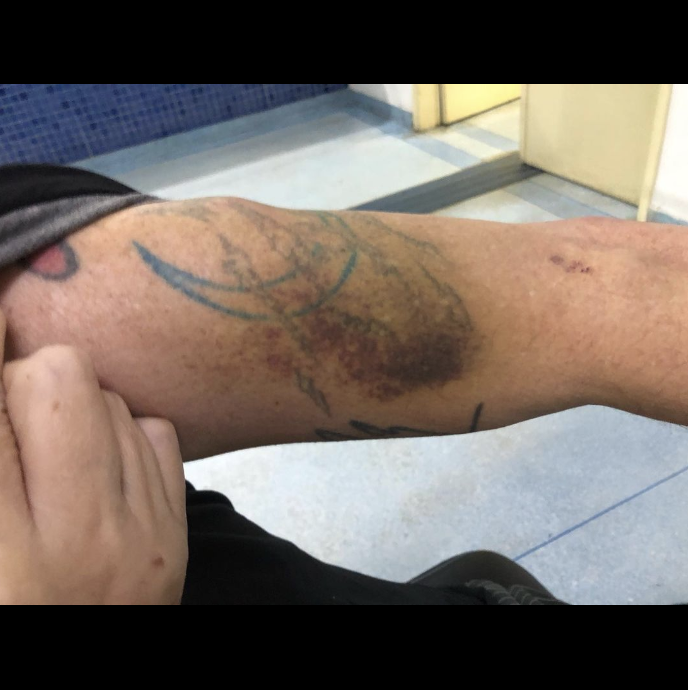 Suposta agressão sofrida por Tognolli e praticada por sua mulher