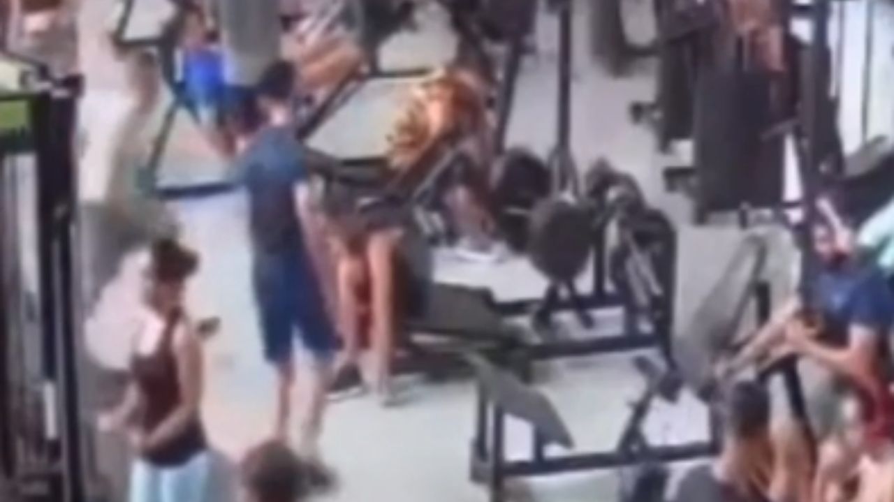 Imagem de aluno depois que aparelho caiu em cima dele