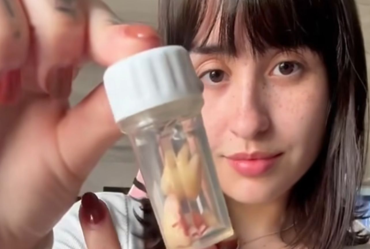 Martina Oliveira segurando pote com seu dente siso e mostrando para a câmera