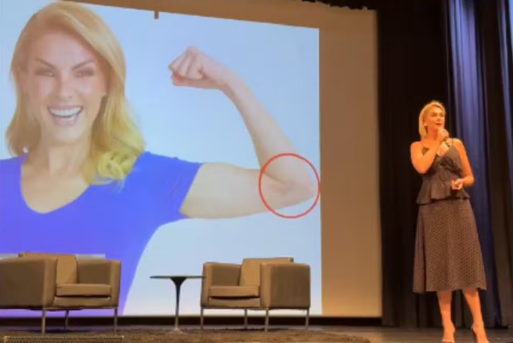 Ana Hickmann em pé, de roupa preta, falando em evento, e foto com hematoma no telão