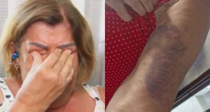 Montagem de fotos de professora Célia Regina e hematomas