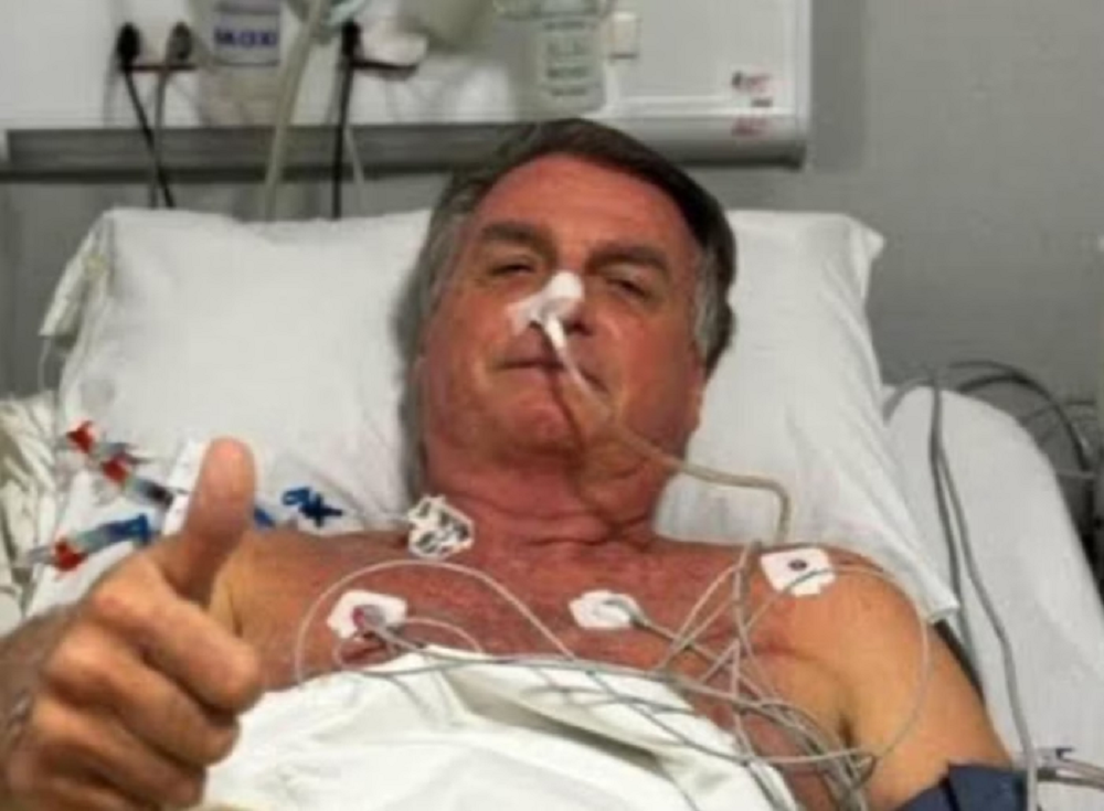O ex-presidente Jair Bolsonaro sem camisa, ligado a aparelhos no hospital