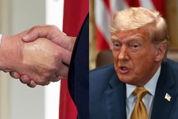 Trump foi visto com mão maquiada e pés inchados antes de diagnóstico de doença crônica