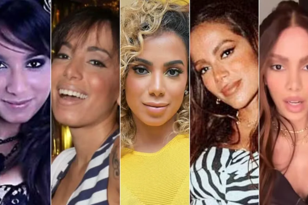 Anitta mudou o rosto - e expôs o vício de toda uma geração. Por Nathalí