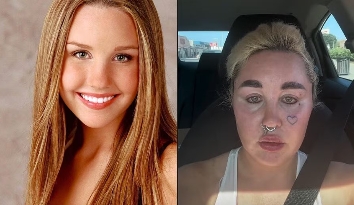 Antes e depois de Amanda Bynes, montagem de duas fotos, uma antiga e uma atual