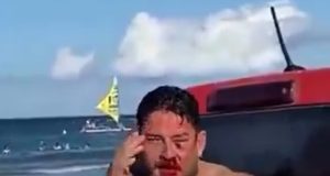 Homem perto do mar com rosto ensanguentado, sem camisa