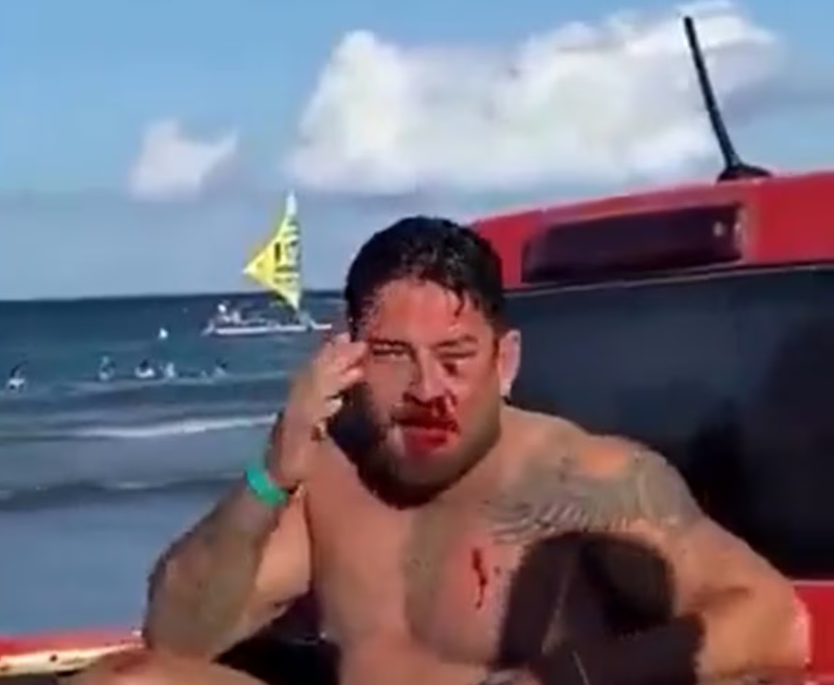 Homem perto do mar com rosto ensanguentado, sem camisa