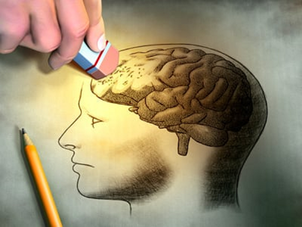Desenho de cérebro sendo apagado