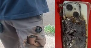 Mecânico após ser atacado por cachorros e celular explodir em montagem de duas fotos