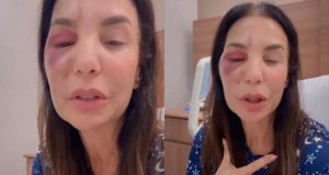 A cantora Ivete Sangalo em montagem de duas fotos, falando para a câmera