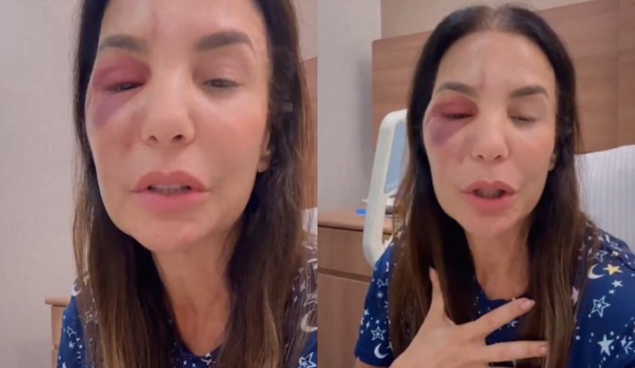 A cantora Ivete Sangalo em montagem de duas fotos, falando para a câmera