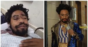 O ator e bailarino Diego Summer em montagem de duas fotos