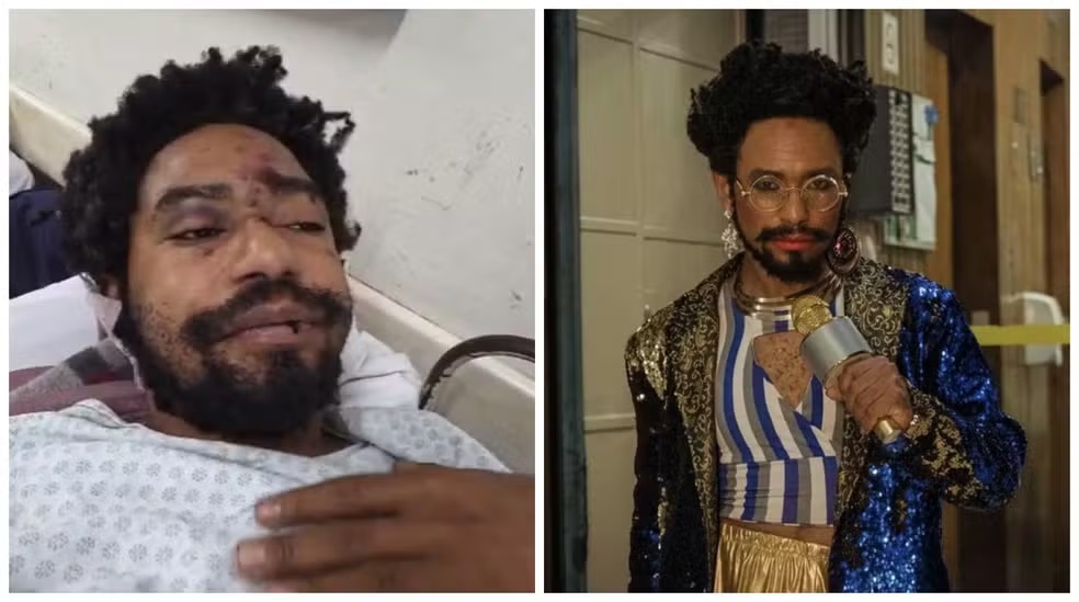 O ator e bailarino Diego Summer em montagem de duas fotos