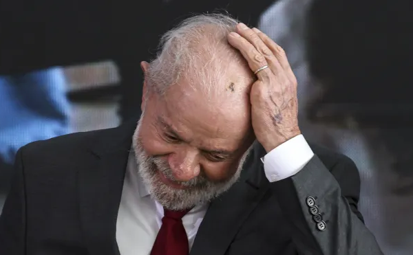Lula passará por cirurgias na cabeça e no punho nesta sexta; saiba os detalhes