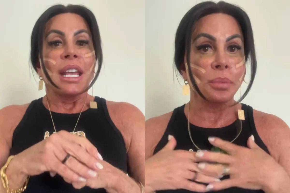 Gretchen durante procedimento estético no rosto