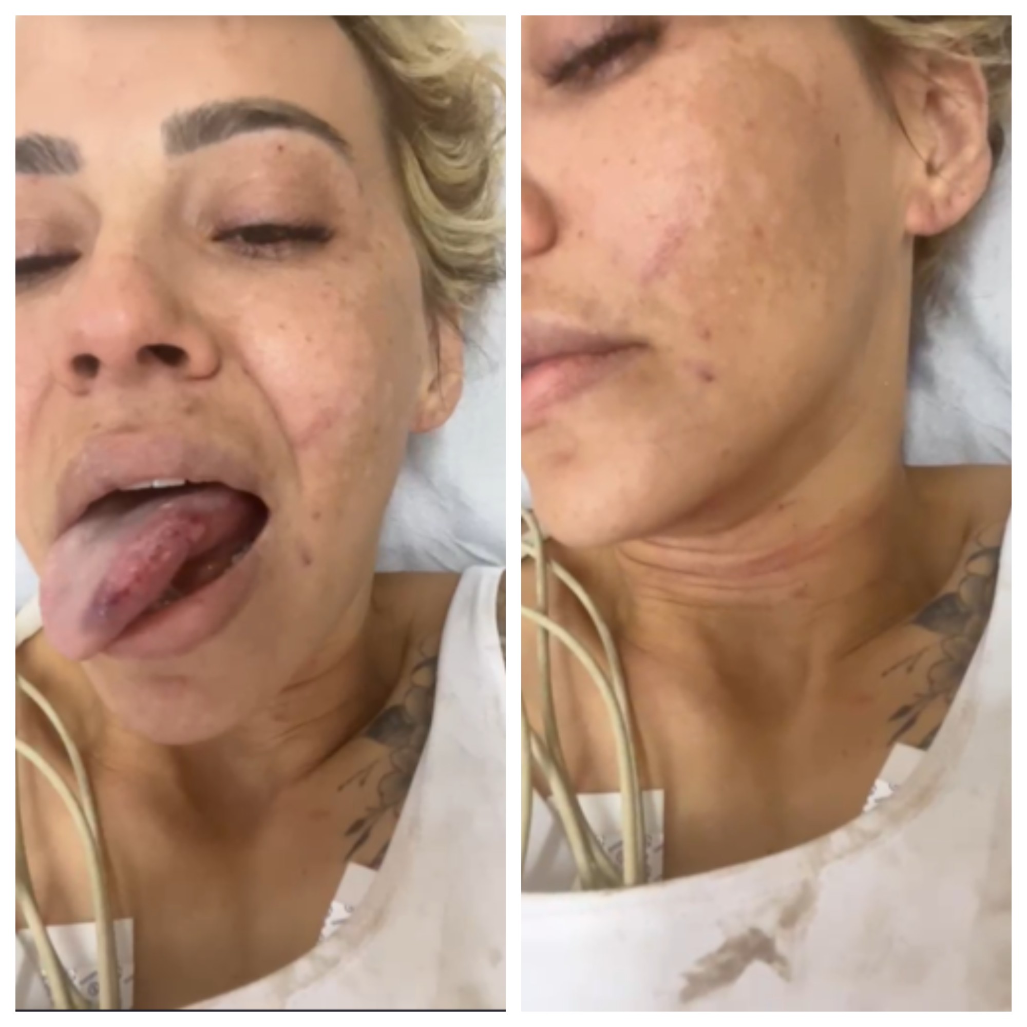 Solange Ribeiro Azevedo com hematomas no rosto