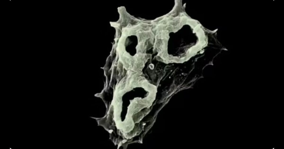 Ameba em visualização microscópica