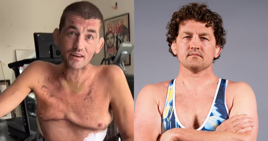 Ben Askren antes e depois de tratamento médico