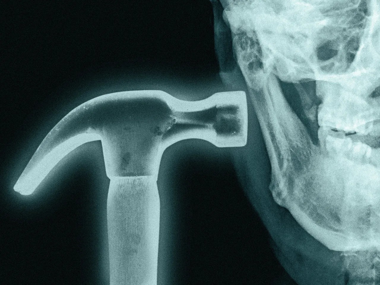 Martelo associado à prática de bonesmashing