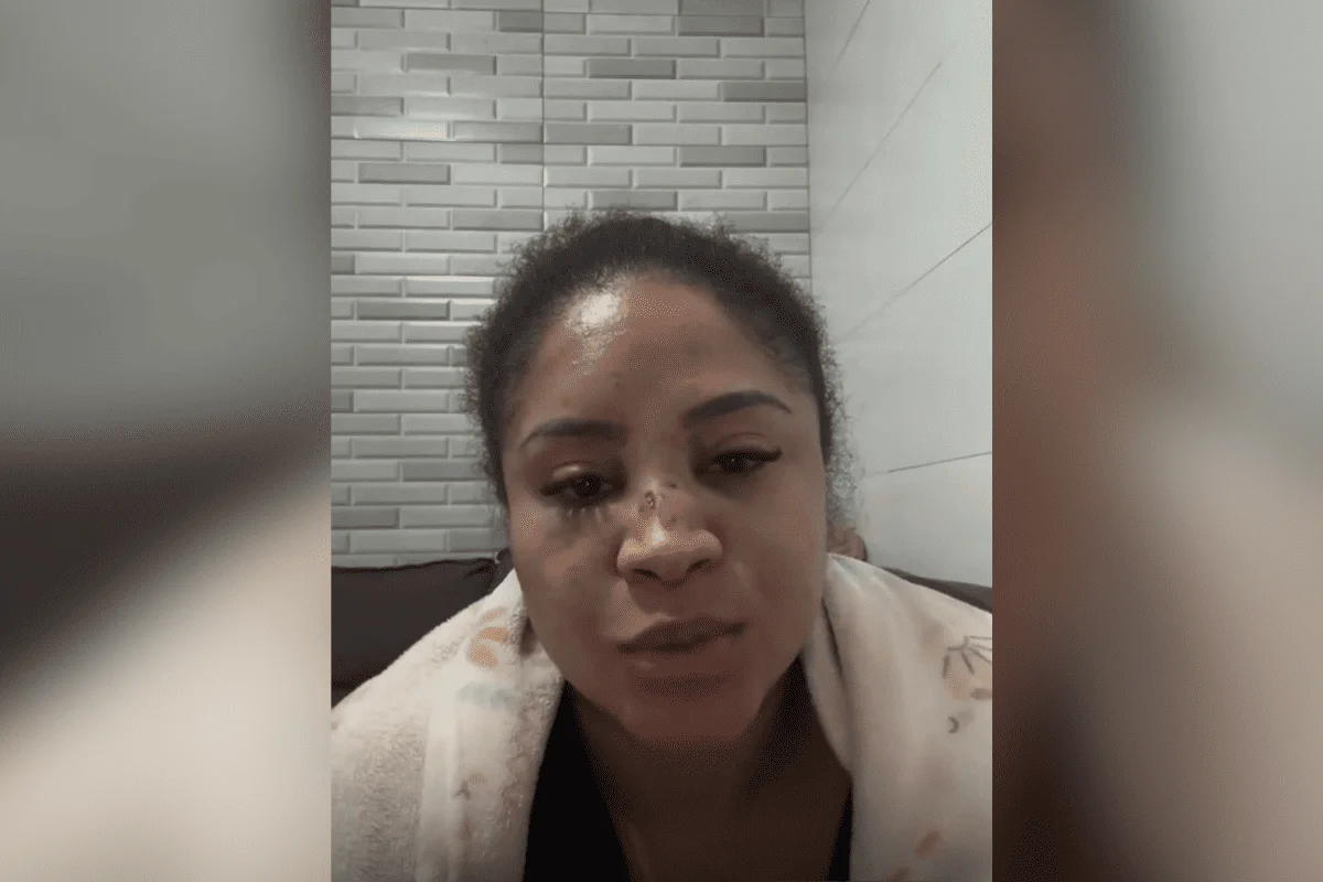 Clyza Sales com hematomas no rosto