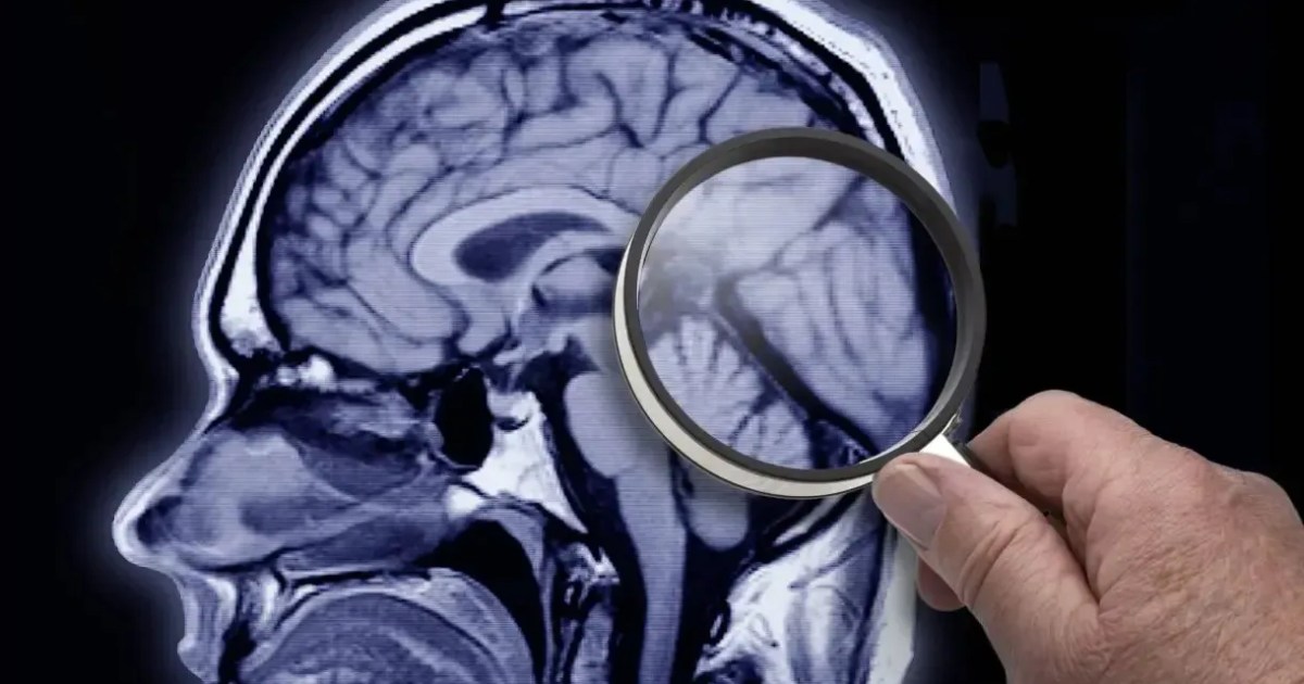 Representação digital de um cérebro humano