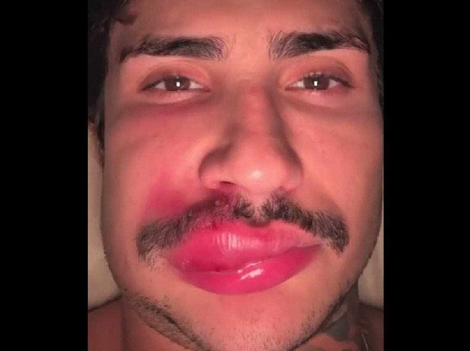 Ken de CG com o lábio inchado