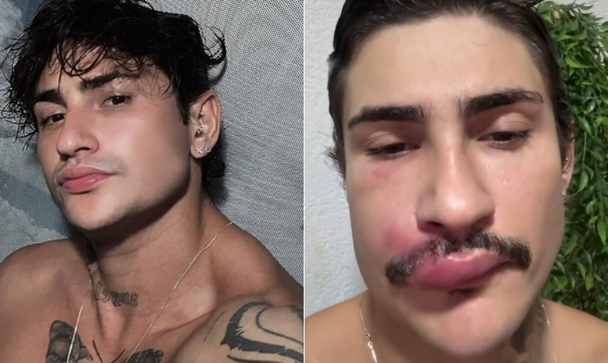 Willian Silva, conhecido como Ken de CG
