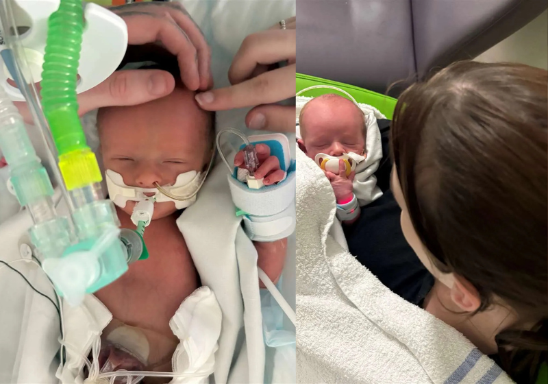 Bebê Luca internado em unidade neonatal