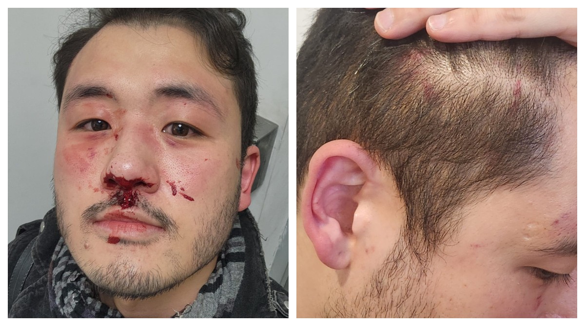 Professor Ricardo Akira Matsufuji com ferimentos no rosto