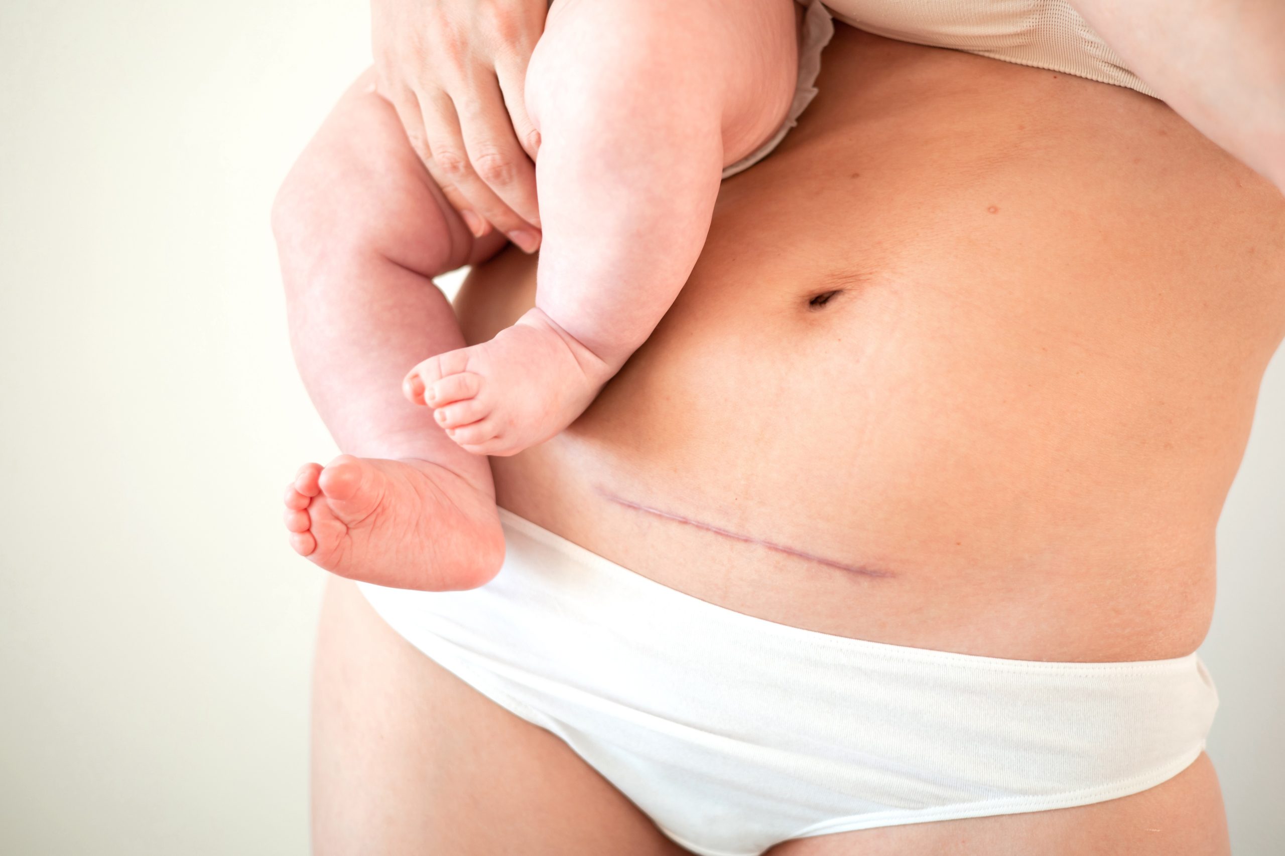 Gestante com as mãos sobre a barriga