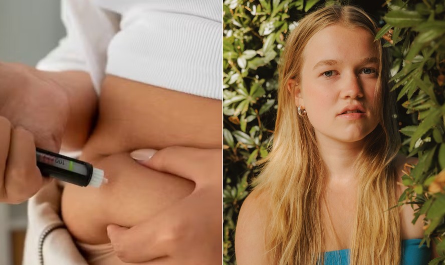 Jessica Johnson, jovem que desenvolveu transtorno alimentar aos 16 anos