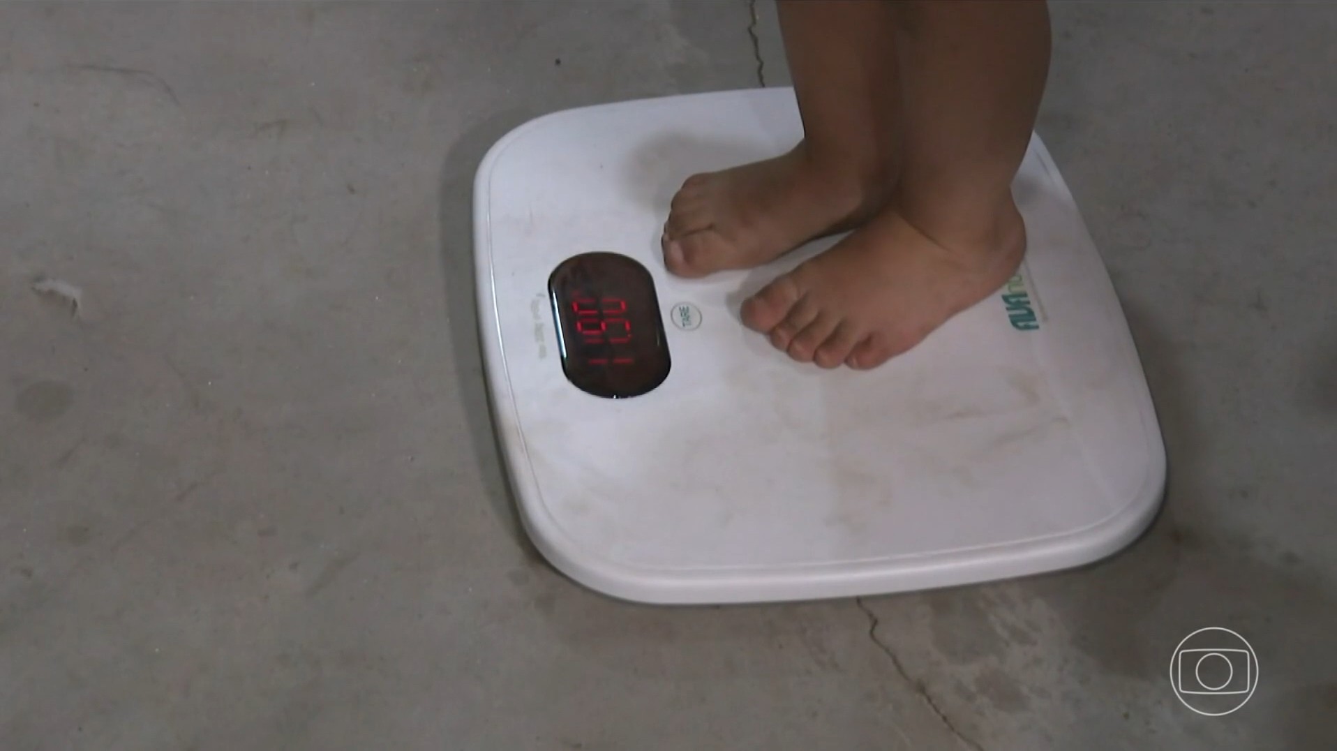 Dados sobre obesidade entre crianças e adolescentes no Brasil