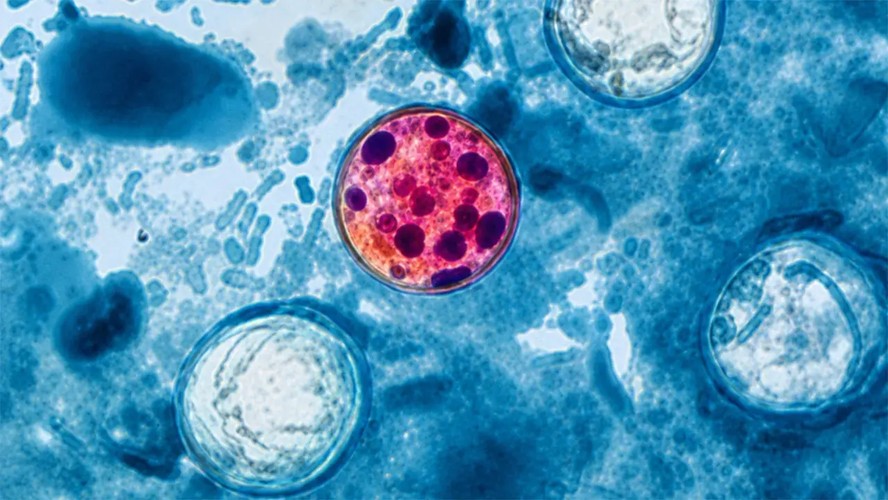 Ilustração sobre ciclosporíase e o parasita Cyclospora
